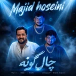 چال گونه مجید حسینی